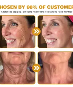 𝐀𝐞𝐞𝐡𝐟𝐞𝐧𝐠® 𝐁𝐎𝐓𝐎𝐗 𝐁𝐞𝐞 𝐕𝐞𝐧𝐨𝐦 𝐒𝐤𝐢𝐧 𝐑𝐞𝐩𝐚𝐢𝐫 𝐂𝐫𝐞𝐚𝐦