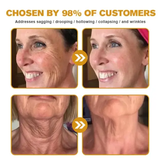 𝐀𝐞𝐞𝐡𝐟𝐞𝐧𝐠® 𝐁𝐎𝐓𝐎𝐗 𝐁𝐞𝐞 𝐕𝐞𝐧𝐨𝐦 𝐒𝐤𝐢𝐧 𝐑𝐞𝐩𝐚𝐢𝐫 𝐂𝐫𝐞𝐚𝐦