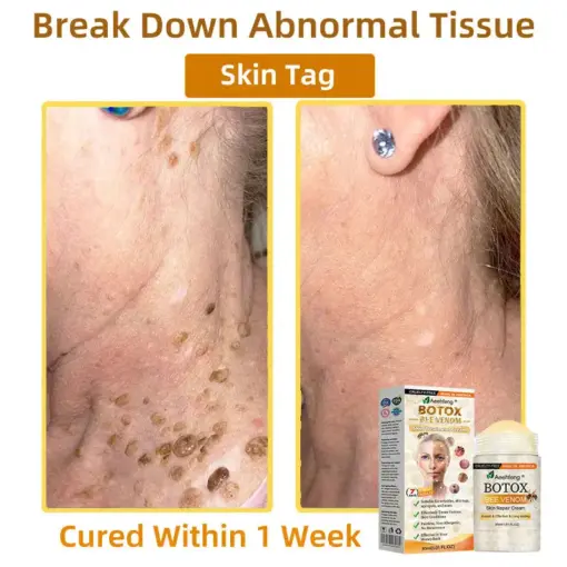 𝐀𝐞𝐞𝐡𝐟𝐞𝐧𝐠® 𝐁𝐎𝐓𝐎𝐗 𝐁𝐞𝐞 𝐕𝐞𝐧𝐨𝐦 𝐒𝐤𝐢𝐧 𝐑𝐞𝐩𝐚𝐢𝐫 𝐂𝐫𝐞𝐚𝐦