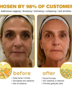 𝐀𝐞𝐞𝐡𝐟𝐞𝐧𝐠® 𝐁𝐎𝐓𝐎𝐗 𝐁𝐞𝐞 𝐕𝐞𝐧𝐨𝐦 𝐒𝐤𝐢𝐧 𝐑𝐞𝐩𝐚𝐢𝐫 𝐂𝐫𝐞𝐚𝐦