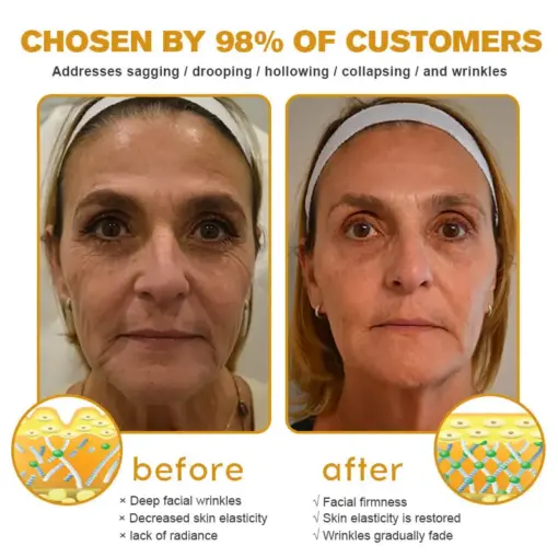 𝐀𝐞𝐞𝐡𝐟𝐞𝐧𝐠® 𝐁𝐎𝐓𝐎𝐗 𝐁𝐞𝐞 𝐕𝐞𝐧𝐨𝐦 𝐒𝐤𝐢𝐧 𝐑𝐞𝐩𝐚𝐢𝐫 𝐂𝐫𝐞𝐚𝐦