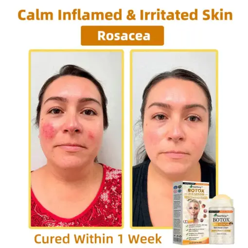 𝐀𝐞𝐞𝐡𝐟𝐞𝐧𝐠® 𝐁𝐎𝐓𝐎𝐗 𝐁𝐞𝐞 𝐕𝐞𝐧𝐨𝐦 𝐒𝐤𝐢𝐧 𝐑𝐞𝐩𝐚𝐢𝐫 𝐂𝐫𝐞𝐚𝐦