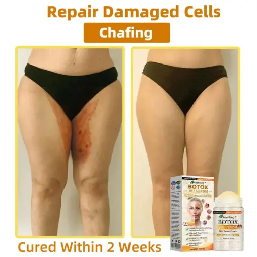 𝐀𝐞𝐞𝐡𝐟𝐞𝐧𝐠® 𝐁𝐎𝐓𝐎𝐗 𝐁𝐞𝐞 𝐕𝐞𝐧𝐨𝐦 𝐒𝐤𝐢𝐧 𝐑𝐞𝐩𝐚𝐢𝐫 𝐂𝐫𝐞𝐚𝐦