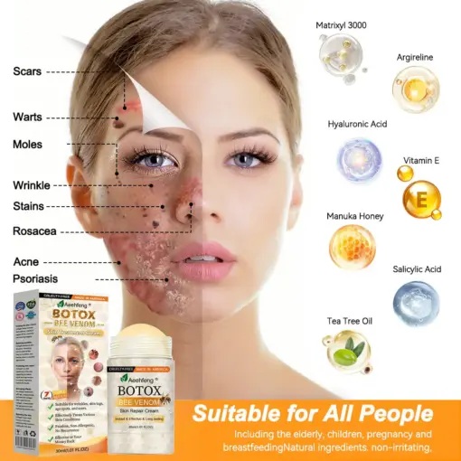 𝐀𝐞𝐞𝐡𝐟𝐞𝐧𝐠® 𝐁𝐎𝐓𝐎𝐗 𝐁𝐞𝐞 𝐕𝐞𝐧𝐨𝐦 𝐒𝐤𝐢𝐧 𝐑𝐞𝐩𝐚𝐢𝐫 𝐂𝐫𝐞𝐚𝐦