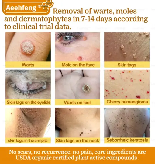 𝐀𝐞𝐞𝐡𝐟𝐞𝐧𝐠® 𝐁𝐎𝐓𝐎𝐗 𝐁𝐞𝐞 𝐕𝐞𝐧𝐨𝐦 𝐒𝐤𝐢𝐧 𝐑𝐞𝐩𝐚𝐢𝐫 𝐂𝐫𝐞𝐚𝐦