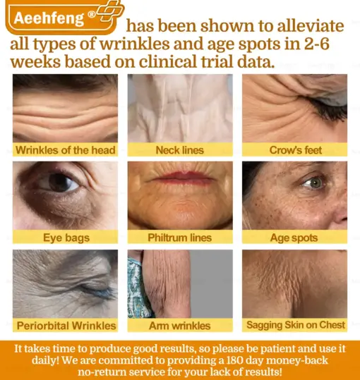 𝐀𝐞𝐞𝐡𝐟𝐞𝐧𝐠® 𝐁𝐎𝐓𝐎𝐗 𝐁𝐞𝐞 𝐕𝐞𝐧𝐨𝐦 𝐒𝐤𝐢𝐧 𝐑𝐞𝐩𝐚𝐢𝐫 𝐂𝐫𝐞𝐚𝐦
