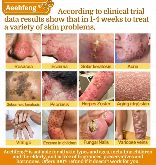 𝐀𝐞𝐞𝐡𝐟𝐞𝐧𝐠® 𝐁𝐎𝐓𝐎𝐗 𝐁𝐞𝐞 𝐕𝐞𝐧𝐨𝐦 𝐒𝐤𝐢𝐧 𝐑𝐞𝐩𝐚𝐢𝐫 𝐂𝐫𝐞𝐚𝐦