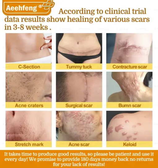 𝐀𝐞𝐞𝐡𝐟𝐞𝐧𝐠® 𝐁𝐎𝐓𝐎𝐗 𝐁𝐞𝐞 𝐕𝐞𝐧𝐨𝐦 𝐒𝐤𝐢𝐧 𝐑𝐞𝐩𝐚𝐢𝐫 𝐂𝐫𝐞𝐚𝐦