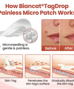Biancat® TagDrop Painless Micro Patch