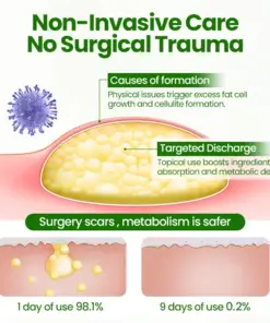 Biancat® KnotAway Lipoma Removal Cream