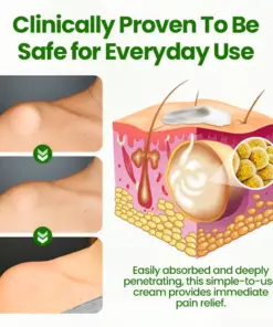 Biancat® KnotAway Lipoma Removal Cream