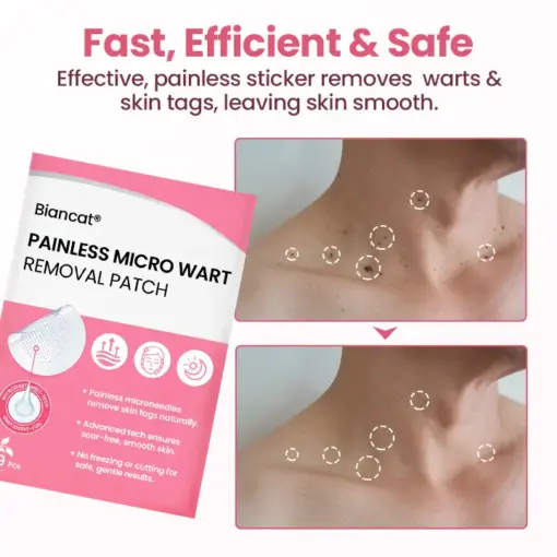Biancat® Painless Micro Wart Removal Patch