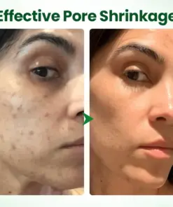 Biancat® PoreMelt Avocado Acid Mask