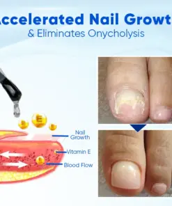 Biancat® OnyxoGuard Nail Growth and Repair Serum