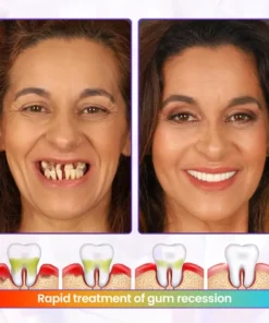 Biancat® BeeRenew Advanced Gum Healing Toothpaste