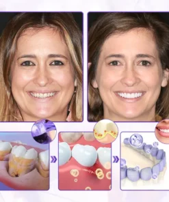 Biancat® BeeRenew Advanced Gum Healing Toothpaste