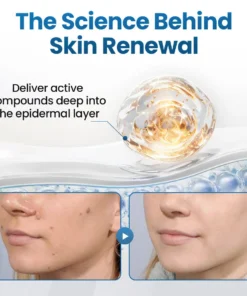 Biancat® BumpFlatten Cream