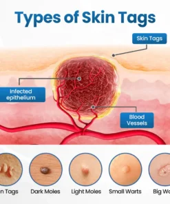 Biancat® BumpFlatten Cream