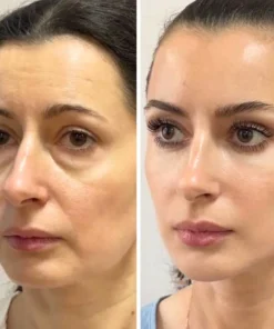 Biancat® LiftRenew All-in-One Augenpflege-Stift