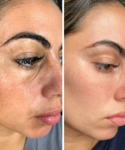 Biancat® LiftRenew All-in-One Augenpflege-Stift