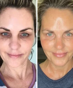 Biancat® LiftRenew All-in-One Augenpflege-Stift