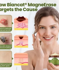 Biancat® MagneErase Renewal Cream