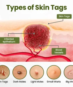 Biancat® MagneErase Renewal Cream