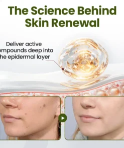 Biancat® MagneErase Renewal Cream