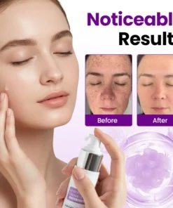 Biancat® SpotErase Probiotic Shield Serum