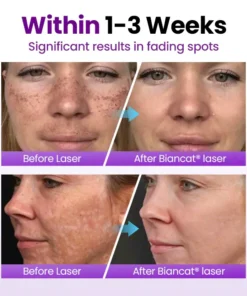 Biancat® SpotErase Probiotic Shield Serum