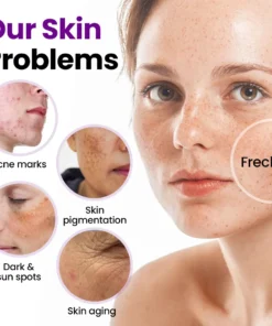 Biancat® SpotErase Probiotic Shield Serum