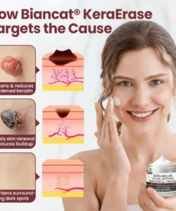 Biancat®KeraErase Dual-Action Renewal Cream