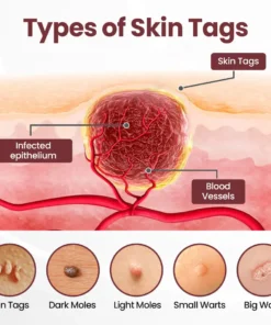 Biancat®KeraErase Dual-Action Renewal Cream