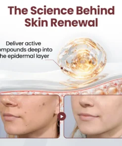 Biancat®KeraErase Dual-Action Renewal Cream