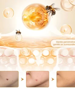 Biancat® BeeVenom Wart Drop Serum