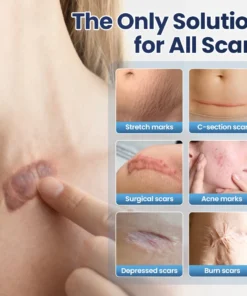 Biancat® DermaFix Texture Repair Gel