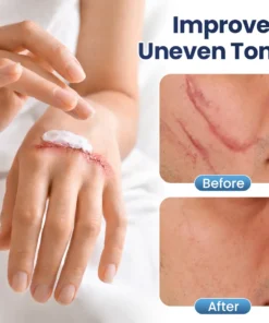 Biancat® DermaFix Texture Repair Gel