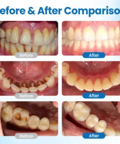 Biancat® NanoHAP Tooth Defense Serum