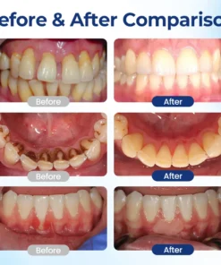 Biancat® GumViva Oral Repair Solution