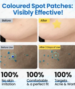Biancat® MicroHydro 2-in-1 Microneedle Patch