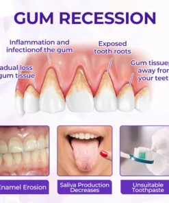 Biancat® SensiGum Fluoride Toothpaste