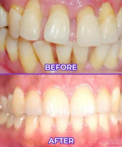 Biancat® SensiGum Fluoride Toothpaste