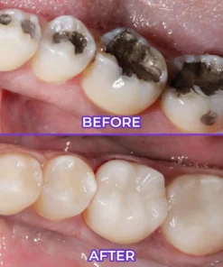 Biancat® SensiGum Fluoride Toothpaste