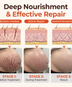 Biancat® SilkStretch Natural Stretch Mark & Scar Oil