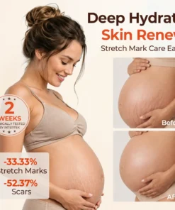 Biancat® SilkStretch Natural Stretch Mark & Scar Oil