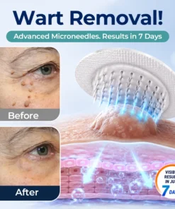 Biancat® BumpVeil Targeted Smoothing Patch