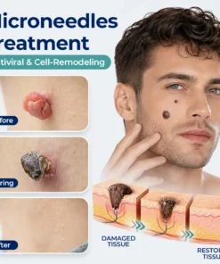 Biancat® BumpVeil Targeted Smoothing Patch