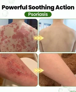 Biancat® DermaOat Botanical Barrier Cream