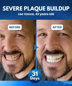 Biancat® ProDenti Tideglusib Tooth and Gum Repair Oral Strips