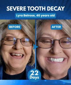 Biancat® ProDenti Tideglusib Tooth and Gum Repair Oral Strips